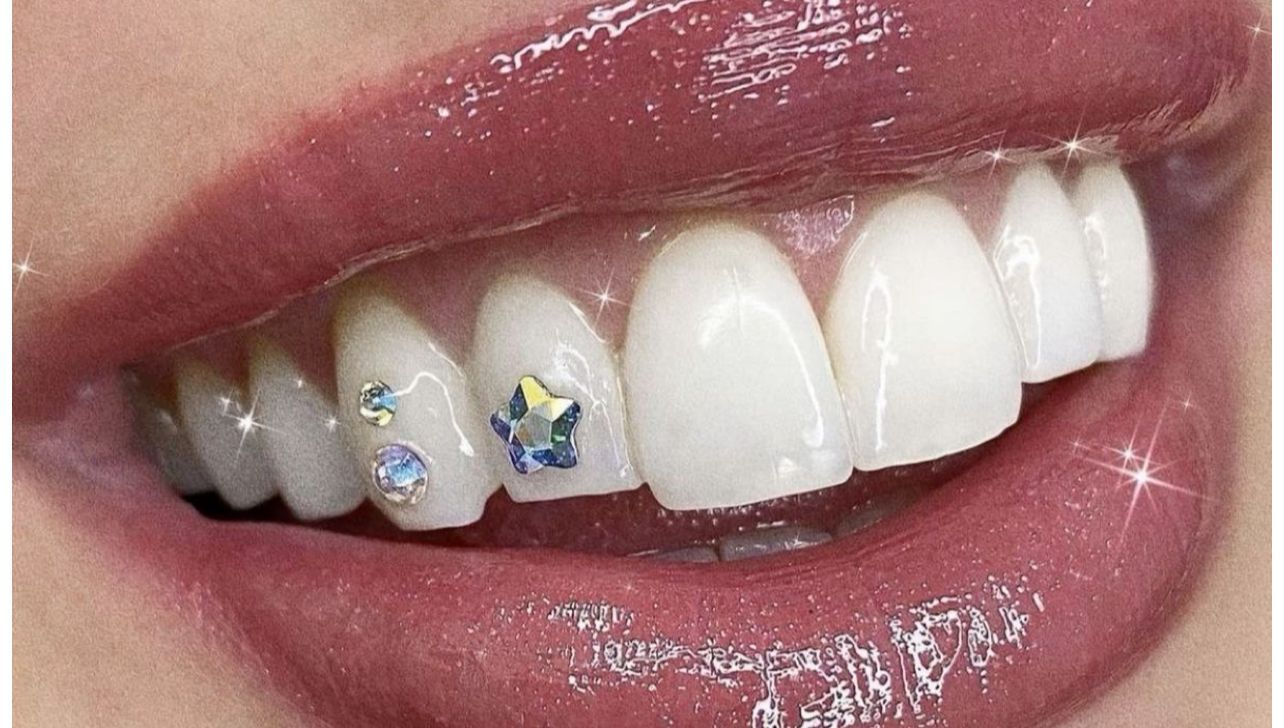 Tooth Gem